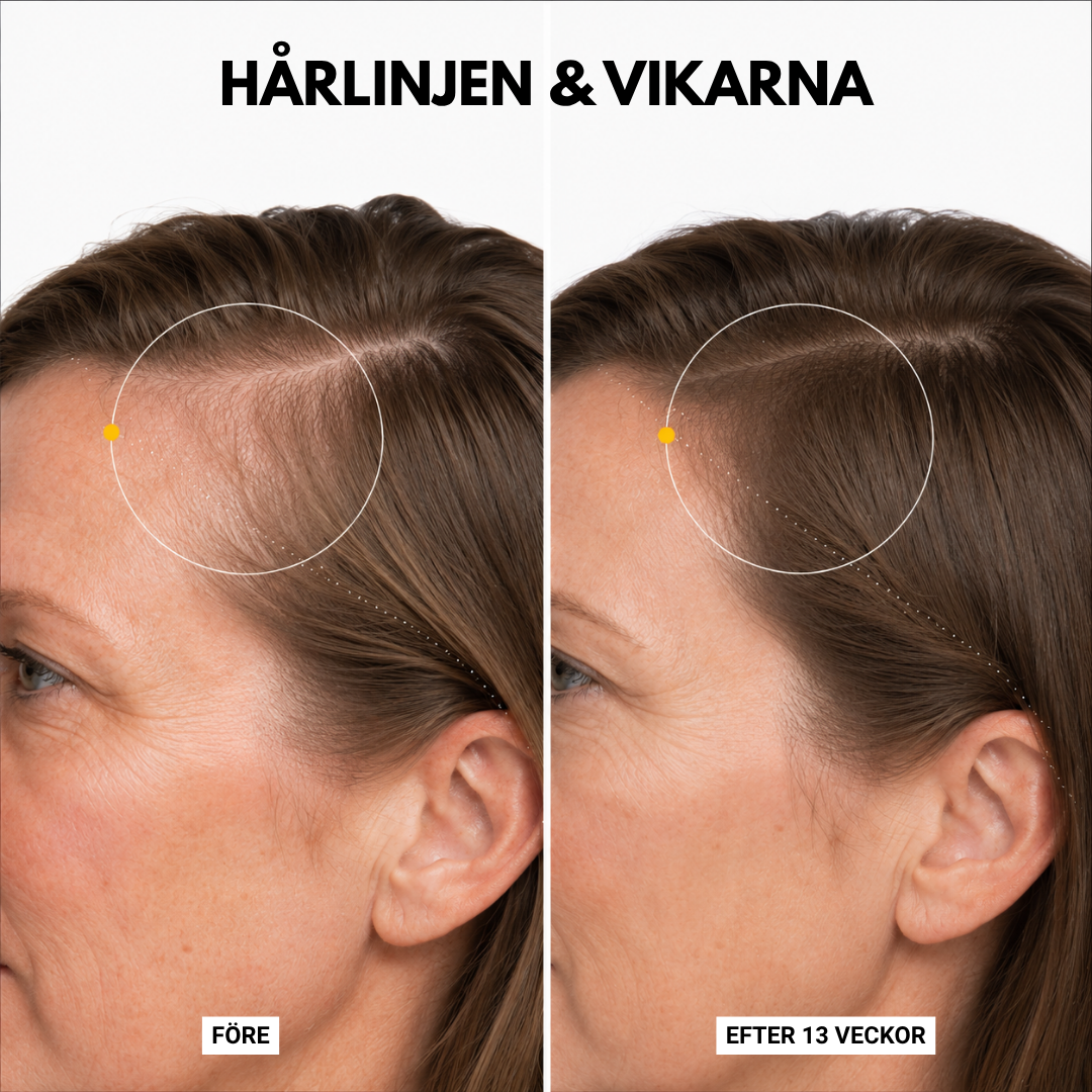 Korea #1 Hårväxt serum™