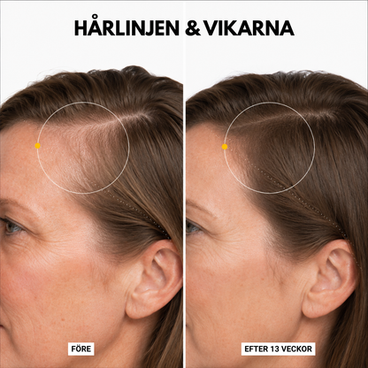 Korea #1 Hårväxt serum™