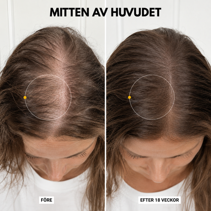 Korea #1 Hårväxt serum™