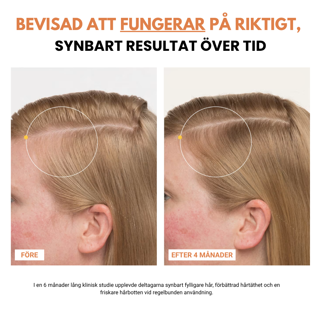 Korea #1 Hårväxt serum