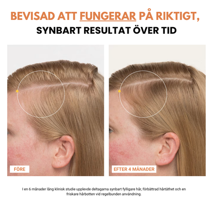 Korea #1 Hårväxt serum