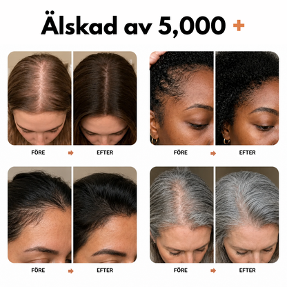 Korea #1 Hårväxt serum™